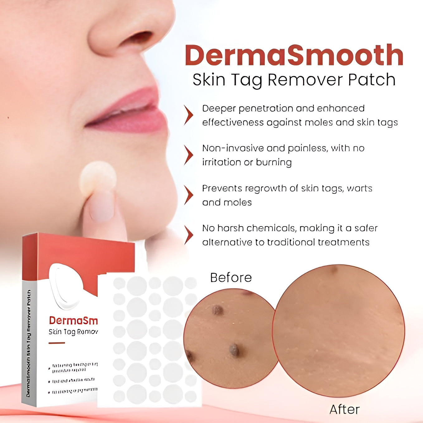 Skin Tag Remover Patch (144 Patches)