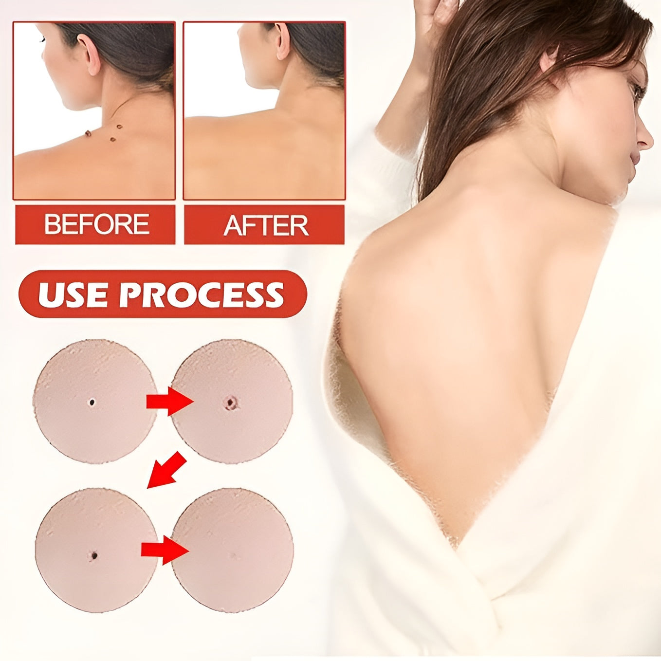 Skin Tag Remover Patch (144 Patches)