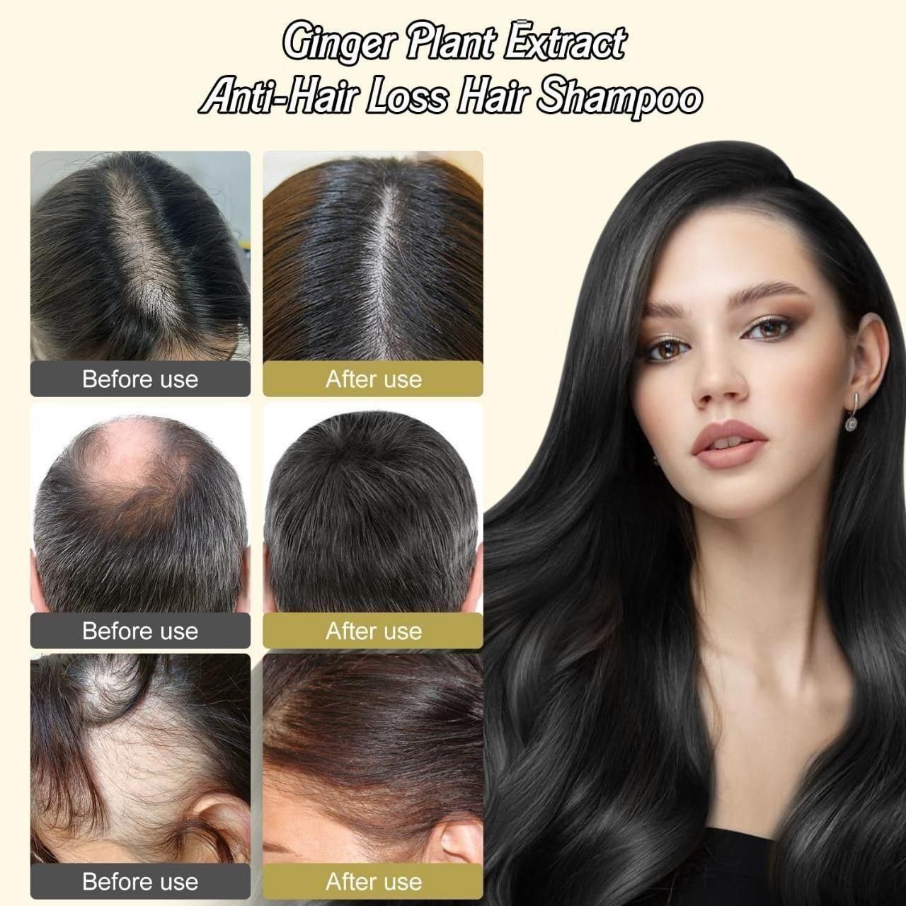 Anti-Hair Loss Shampoo – Reduces Hair Fall, Strengthens Roots, Promotes Growth, Nourishes Scalp – Sulfate-Free Formula, 600 ml Pack of 3