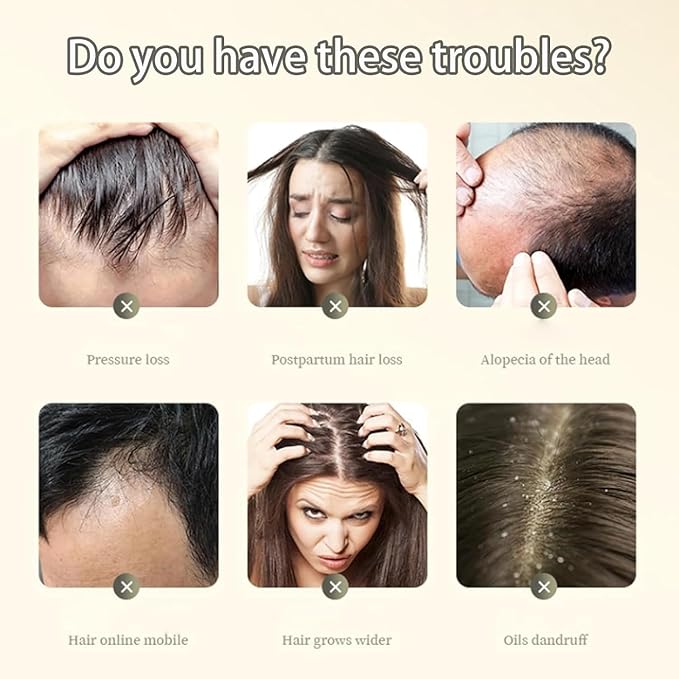 Anti-Hair Loss Shampoo – Reduces Hair Fall, Strengthens Roots, Promotes Growth, Nourishes Scalp – Sulfate-Free Formula, 600 ml Pack of 3