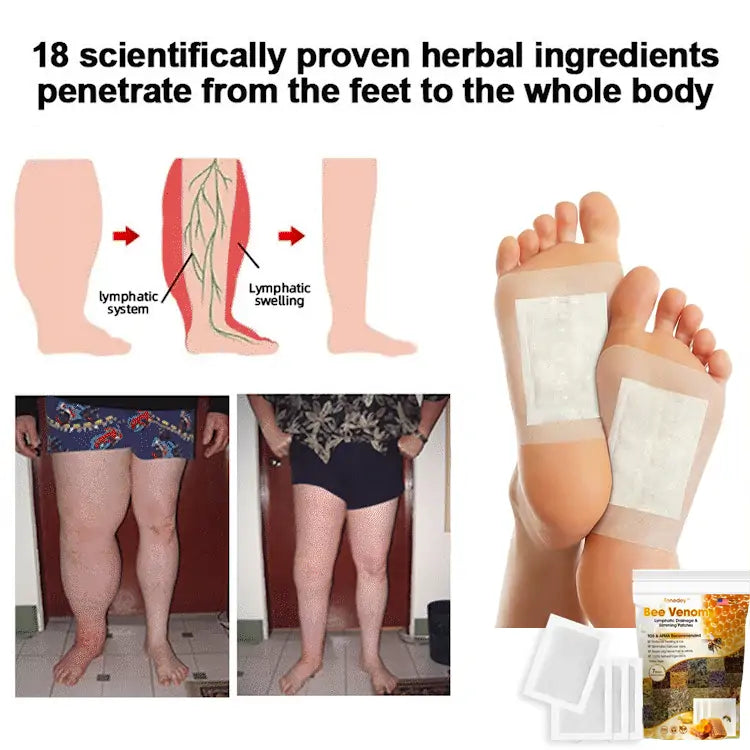 Bee Venom Lymphatic Damage & Sliming Patches (10 Patches)