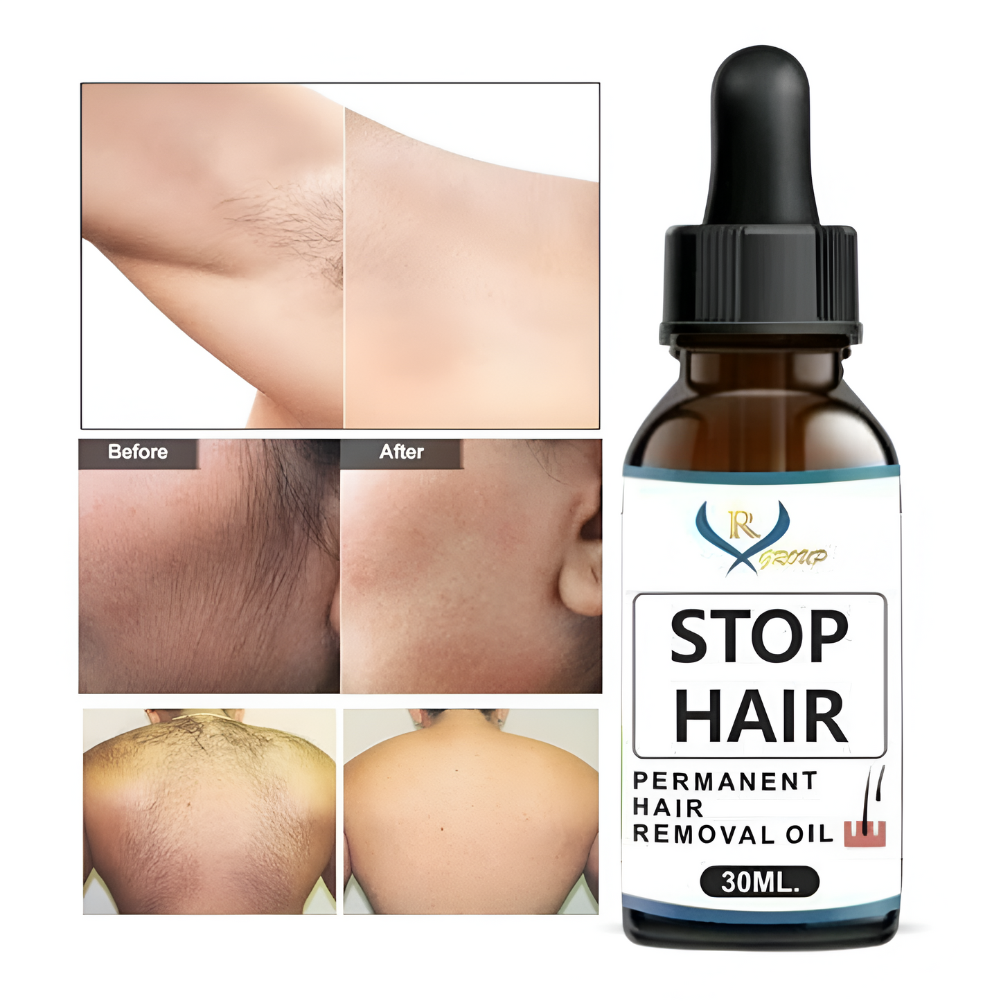 Stop Hair Oil for Permanent Hair Removal – Safe, Natural & Pain-Free Solution (Pack of 1 )