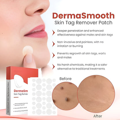 Skin Tag Remover Patch (144 Patches)