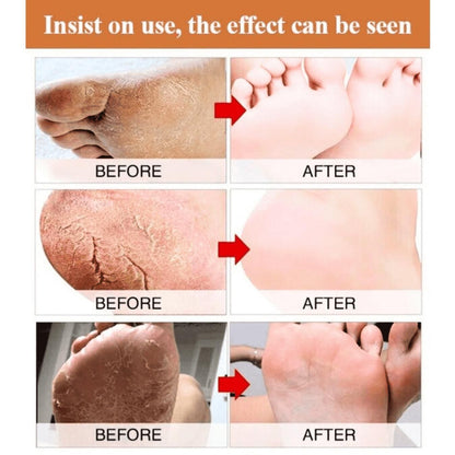 Healing Foot Cream – Cracked Heels & Dry Skin Relief (200 ml)