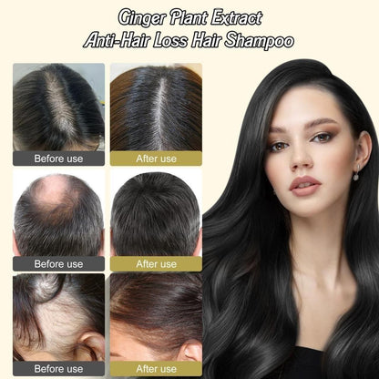 Anti-Hair Loss Shampoo – Reduces Hair Fall, Strengthens Roots, Promotes Growth, Nourishes Scalp – Sulfate-Free Formula, 600 ml Pack of 3