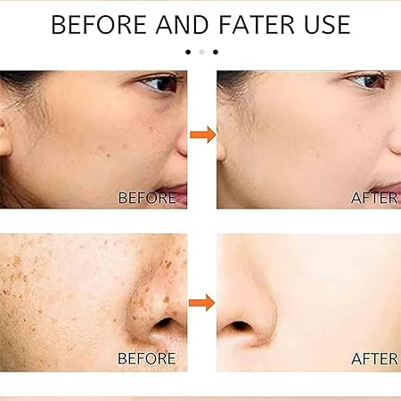 Saam renewal face cream, remove wrinkles, melasma, freckles, skin aging, dark skin (Pack Of 2)