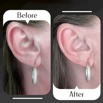 Premium Earlobe Support Patches (100 PCS)